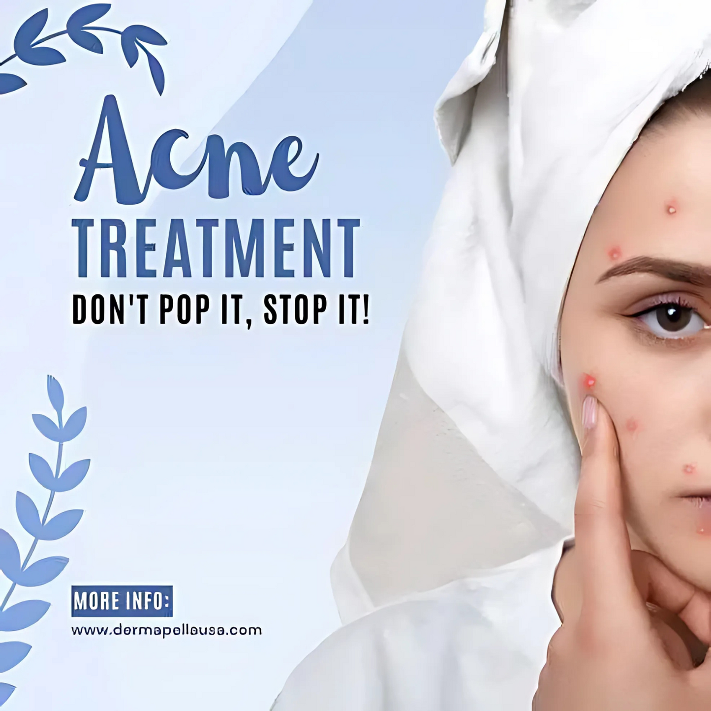 Derma Pella Acne Care Gel – Pore & Blemish Reduction | Skincare Gel | Clearance